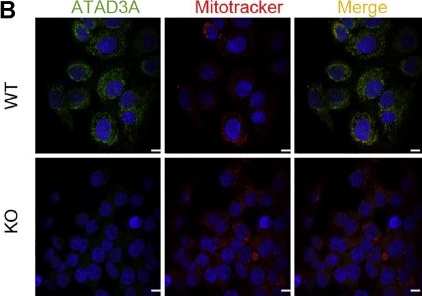 Fig.2.B showing Immunocytochemistry-immunofluorescence from the publication: Loss of mitochondrial ATPase ATAD3A contributes to nonalcoholic fatty liver disease through accumulation of lipids and damaged mitochondria.