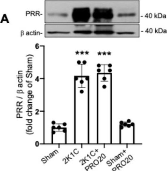 Fig.4.A showing Western Blotting in a Mus musculus (House mouse) sample from the publication: (Pro)renin Receptor Blockade Prevents Increases in Systolic Blood Pressure, Sodium Retention, and αENaC Protein Expression in the Kidney of 2K1C Goldblatt Mice.
