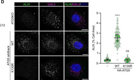 Fig.2.D showing Immunocytochemistry-immunofluorescence in a Homo sapiens (Human) sample from the publication: The&nbsp;ATG8 E3-like ligases sense lysosomal damage and initiate ESCRT-mediated membrane repair.