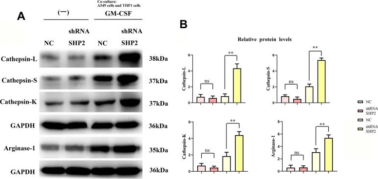 Fig.3.A showing Western Blotting from the publication: SHP2 mediates STAT3/STAT6 signaling pathway in TAM to inhibit proliferation and metastasis of lung adenocarcinoma.