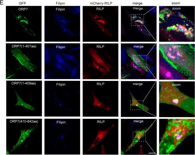 Fig.7.E showing Immunocytochemistry-immunofluorescence in a Homo sapiens (Human) sample from the publication: RILP Induces Cholesterol Accumulation in Lysosomes by Inhibiting Endoplasmic Reticulum-Endolysosome Interactions.