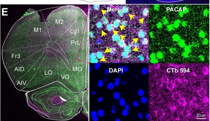 Fig.1.E showing Immunohistochemistry-immunofluorescence in a Rattus norvegicus (Rat) sample from the publication: PACAP Signalling Network in the Nucleus Accumbens Core Regulates Reinstatement Behaviour in Rat.