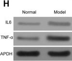 Fig.5.H showing Western Blotting in a Homo sapiens (Human) sample from the publication: Integrative biology shows DPP4 affects inflammatory response to eclampsia and cell model growth via p65/NLRP3/ASC/Caspase-1 pathway.