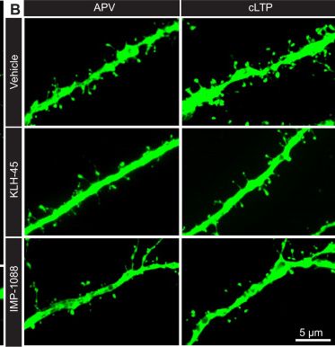 Fig.6.B from the publication: Lysine myristoylation mediates long-term potentiation via membrane enrichment of synaptic plasticity effectors.