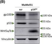 Wnt5a/b (C27E8) Rabbit Monoclonal Antibody | Cell Signaling Technology