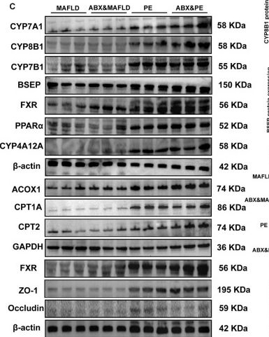 Fig.8.C showing Western Blotting in an Ovis aries (Sheep) sample from the publication: Wendan decoction modulates Parasutterella to influence fatty acid metabolism in MAFLD via the FXR/PPARα/CYP4A12A axis.