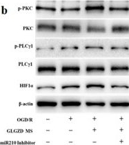 Fig.5.B showing Western Blotting in a Homo sapiens (Human) sample from the publication: Gualou Guizhi decoction promotes therapeutic angiogenesis via the miR210/HIF/VEGF pathway in vivo and in vitro.