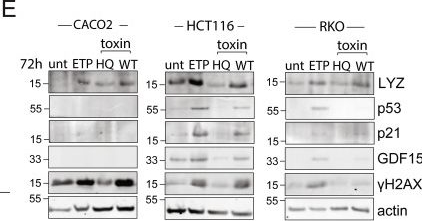 Fig.5.E showing Western Blotting in a Homo sapiens (Human) sample from the publication: Typhoid toxin of Salmonella Typhi elicits host antimicrobial response during acute typhoid fever.