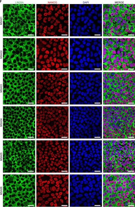 Fig.1.F showing Immunocytochemistry-immunofluorescence in a Homo sapiens (Human) sample from the publication: Generation and characterization of human induced pluripotent stem cells from neuropathologically confirmed multiple system atrophy patient-derived fibroblasts.