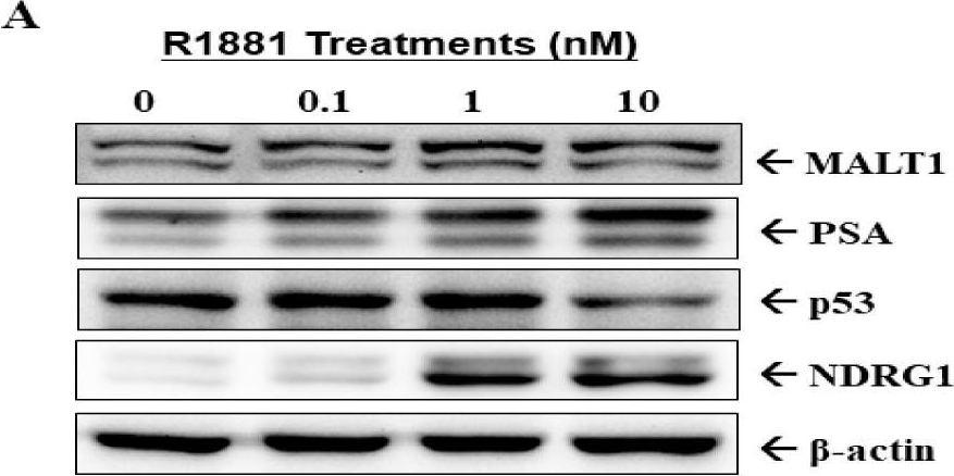 Fig.1.A showing Western Blotting from the publication: Androgen Receptor Upregulates Mucosa-Associated Lymphoid Tissue 1 to Induce NF-κB Activity via Androgen-Dependent and -Independent Pathways in Prostate Carcinoma Cells.