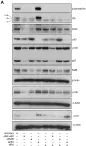 Fig.7.A showing Western Blotting from the publication: Regulation of p53 and Rb links the alternative NF-κB pathway to EZH2 expression and cell senescence.