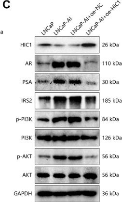 Fig.4.C showing Western Blotting from the publication: Emerging role of HIC1 in prostate cancer progression and therapeutic response: A novel perspective.