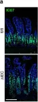 Fig.3.A showing Immunohistochemistry-immunofluorescence in a Mus musculus (House mouse) sample from the publication: ERK5 signalling rescues intestinal epithelial turnover and tumour cell proliferation upon ERK1/2 abrogation.