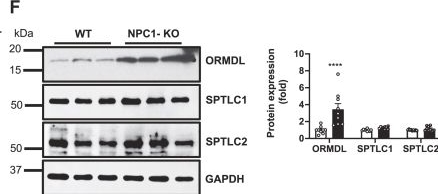 Fig.1.F showing Western Blotting from the publication: ORMDL mislocalization by impaired autophagy in Niemann-Pick type C disease leads to increased de novo sphingolipid biosynthesis.