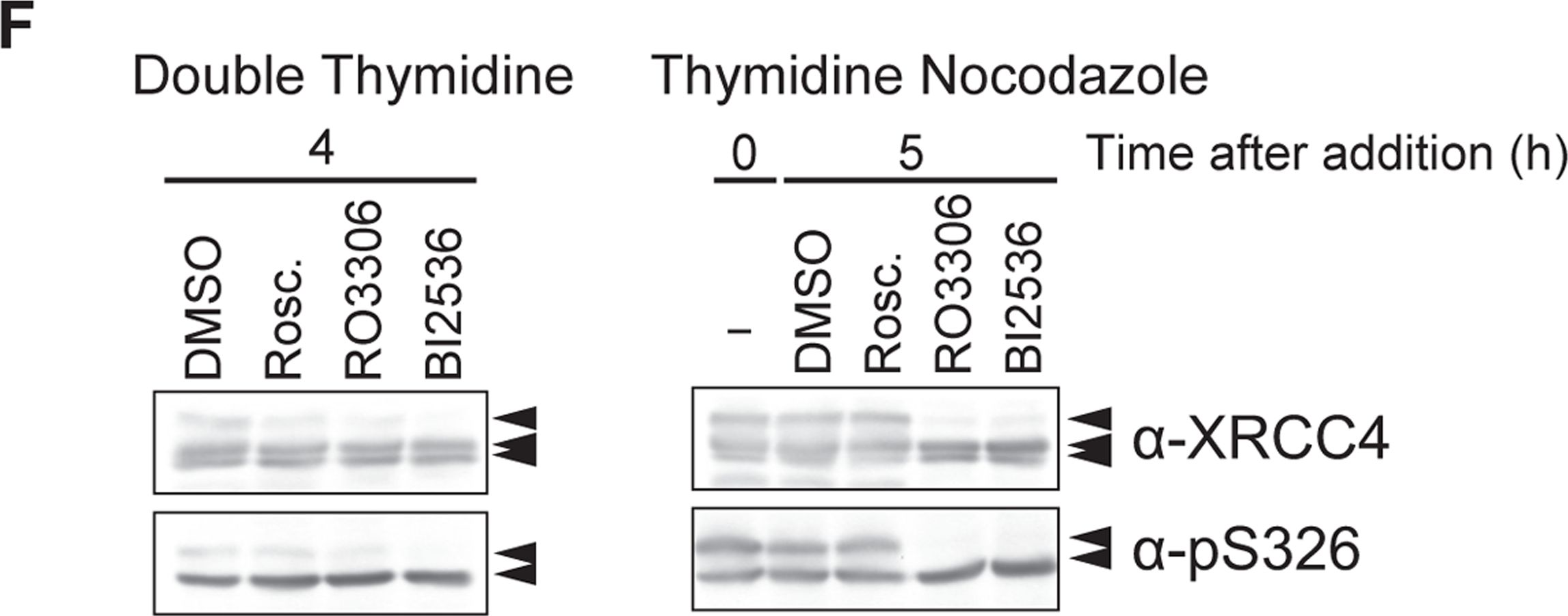 Fig.4.F showing Western Blotting in a Homo sapiens (Human) sample from the publication: Canonical non-homologous end joining in mitosis induces genome instability and is suppressed by M-phase-specific phosphorylation of XRCC4.