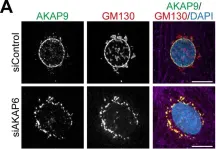 Fig.3.A showing Immunocytochemistry-immunofluorescence from the publication: AKAP6 orchestrates the nuclear envelope microtubule-organizing center by linking golgi and nucleus via AKAP9.