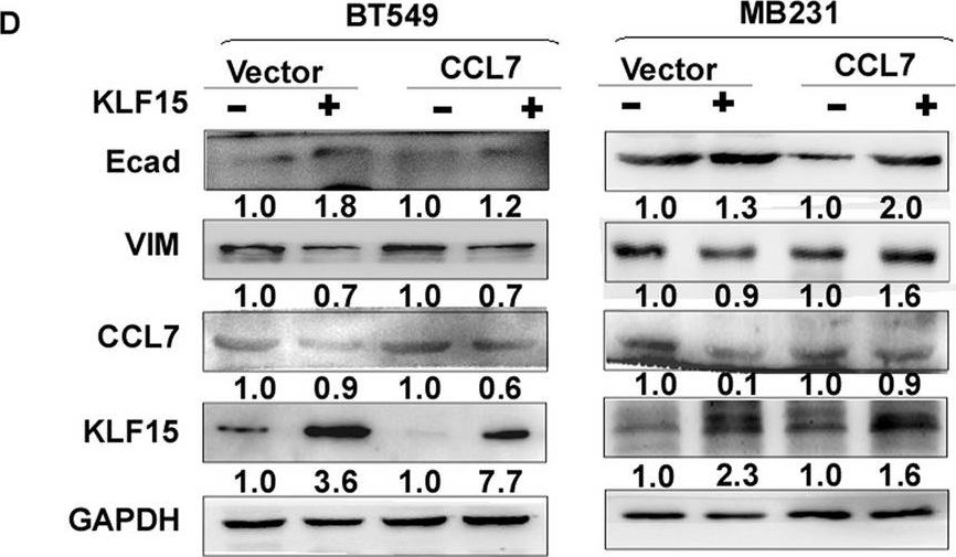 Fig.7.D showing Western Blotting in a Homo sapiens (Human) sample from the publication: KLF15 suppresses tumor growth and metastasis in Triple-Negative Breast Cancer by downregulating CCL2 and CCL7.