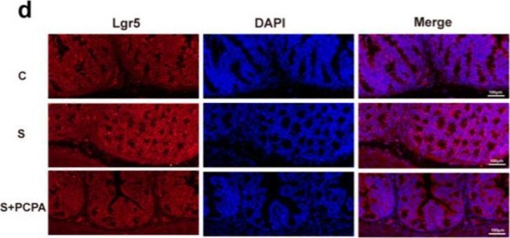 Fig.3.D from the publication: Restraint Stress Disrupted Intestinal Homeostasis via 5-HT/HTR7/Wnt/β-Catenin/NF-kB Signaling.