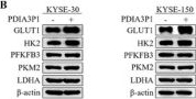 Fig.3.B showing Western Blotting from the publication: WTAP Mediated m6A Modification Stabilizes PDIA3P1 and Promotes Tumor Progression Driven by Histone Lactylation in Esophageal Squamous Cell Carcinoma.