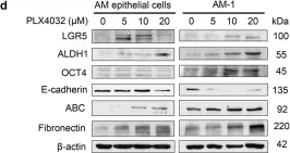 Fig.6.D showing Western Blotting from the publication: LGR5+ epithelial tumor stem-like cells generate a 3D-organoid model for ameloblastoma.