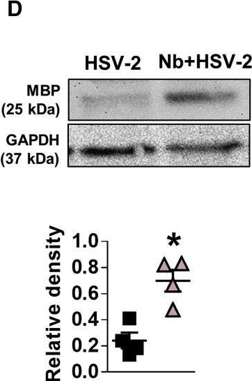 Fig.3.D showing Western Blotting from the publication: Il4ra-independent vaginal eosinophil accumulation following helminth infection exacerbates epithelial ulcerative pathology of HSV-2 infection.