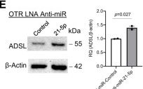 Fig.3.E showing Western Blotting in a Homo sapiens (Human) sample from the publication: MicroRNA-21 guide and passenger strand regulation of adenylosuccinate lyase-mediated purine metabolism promotes transition to an EGFR-TKI-tolerant persister state.