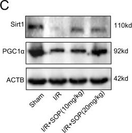 Fig.6.C showing Western Blotting in a Mus musculus (House mouse) sample from the publication: Sophocarpine Alleviates Renal Ischemia-Reperfusion Injury by Mitigating Oxidative Stress and Mitochondrial Dysfunction via the SIRT1/PGC-1α Axis.