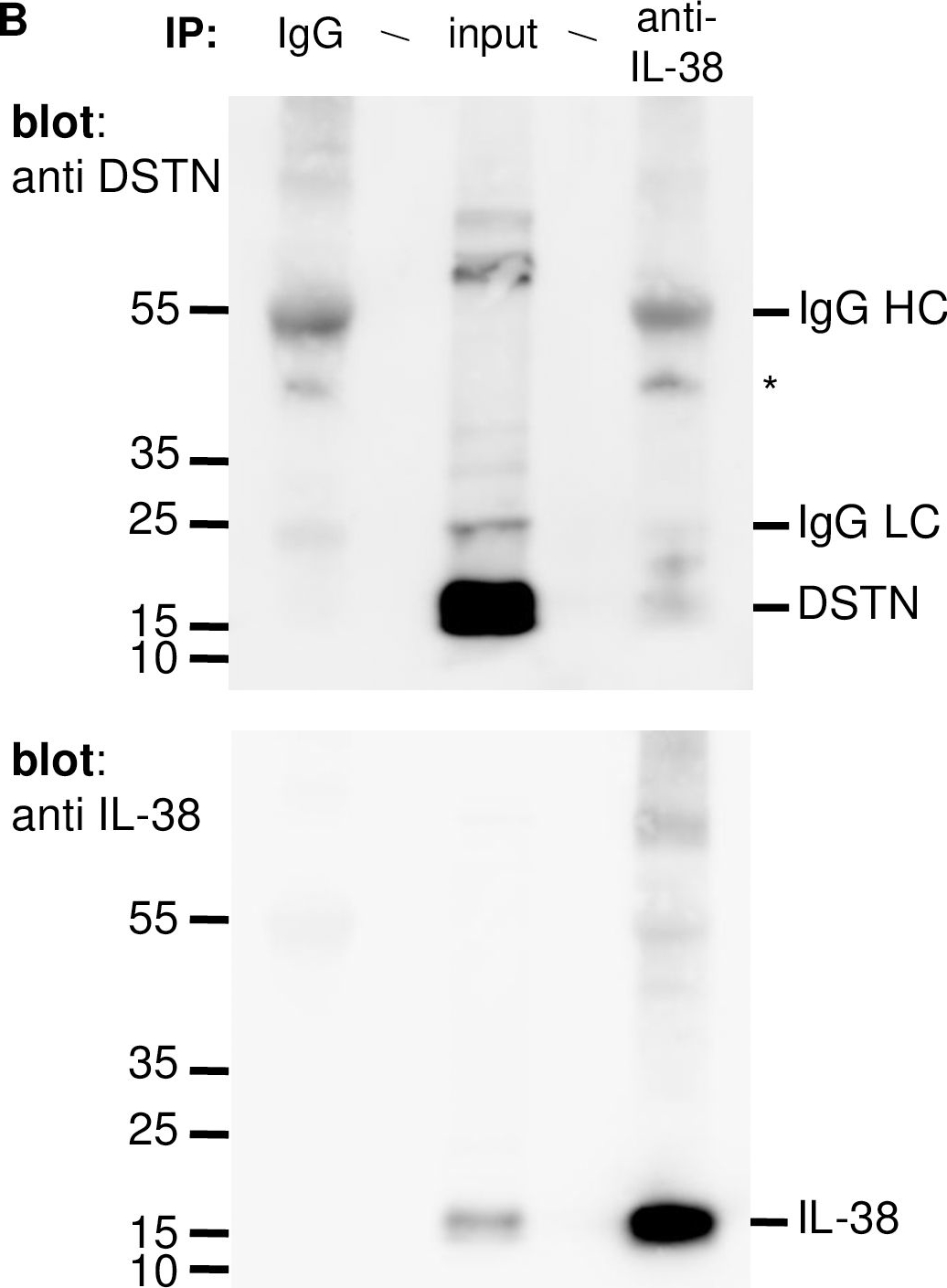 Fig.2.B showing Western Blotting in a Homo sapiens (Human) sample from the publication: Interleukin-38 interacts with destrin/actin-depolymerizing factor in human keratinocytes.