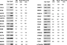 Fig.3.A showing Western Blotting in a Homo sapiens (Human) sample from the publication: A quantitative proteomic analysis uncovers the relevance of CUL3 in bladder cancer aggressiveness.
