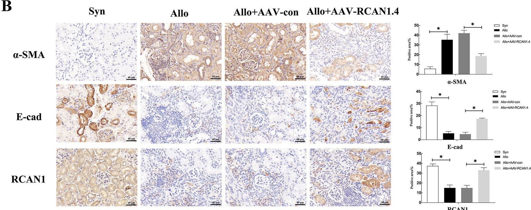Fig.3.B showing Immunohistochemistry from the publication: Disruption of RCAN1.4 expression mediated by YY1/HDAC2 modulates chronic renal allograft interstitial fibrosis.