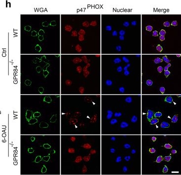 Fig.4.H showing Immunocytochemistry-immunofluorescence in a Mus musculus (House mouse) sample from the publication: GPR84 regulates pulmonary inflammation by modulating neutrophil functions.