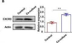 Fig.3.B showing Western Blotting in a Homo sapiens (Human) sample from the publication: Reciprocal activation between M1 macrophages and trophoblasts through CXCL9/STAT1/ZEB1/CCL2 axis promotes recurrent spontaneous abortion.