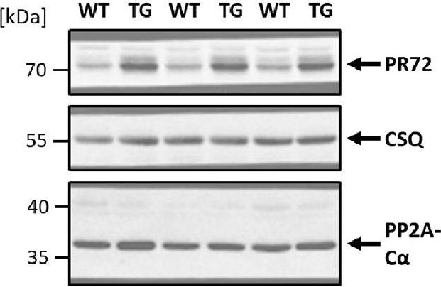Fig.2.A showing Western Blotting in a Mus musculus (House mouse) sample from the publication: Hypercontractile cardiac phenotype in mice overexpressing the regulatory subunit PR72 of protein phosphatase 2A.