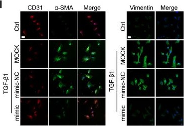 Fig.8.I showing Immunocytochemistry-immunofluorescence from the publication: miR-15a-5p outperforms anti-VEGF drug in ocular neovascularization by providing dual anti-angiogenic and neuroprotective effects.