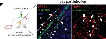 Fig.2.F showing Immunohistochemistry-immunofluorescence in a Mus musculus (House mouse) sample from the publication: Staphylococcus Aureus Tames Nociceptive Neurons to Suppress Synovial Macrophage Responses for Sustained Infection in Septic Arthritis.