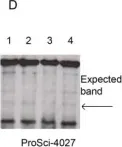 Fig.5.D showing Western Blotting in a Homo sapiens (Human) sample from the publication: Chemoattractant receptor homologous to the T helper 2 cell (CRTH2) is not expressed in human amniocytes and myocytes.