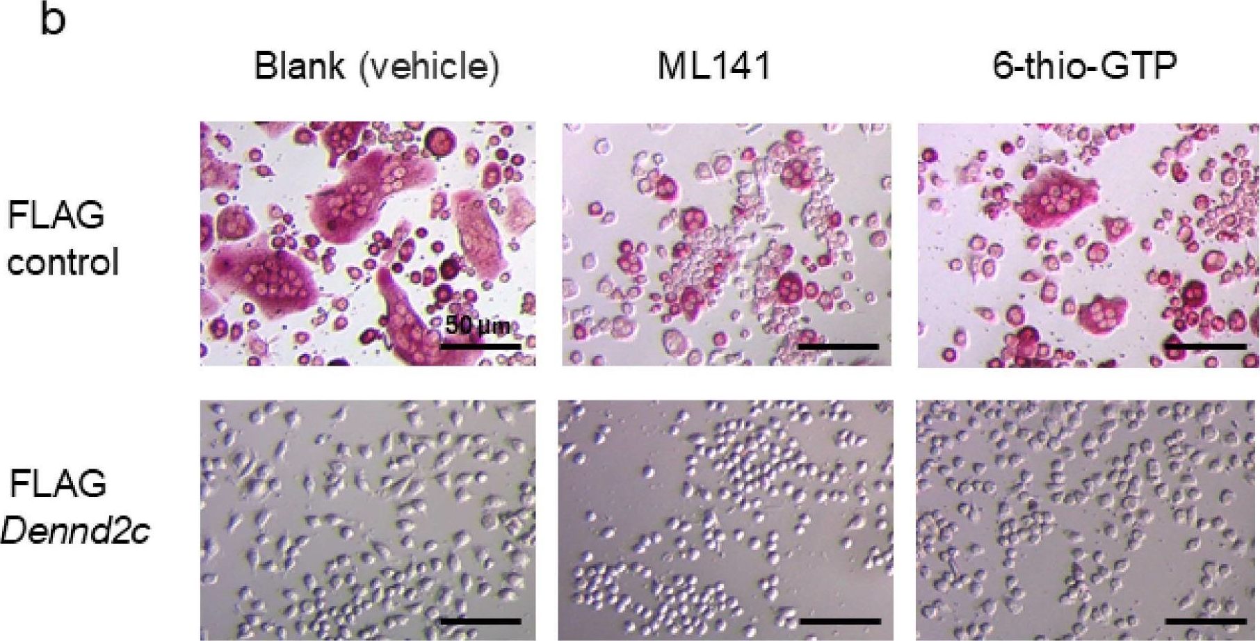 Fig.7.B showing Immunohistochemistry from the publication: Dennd2c Negatively Controls Multinucleation and Differentiation in Osteoclasts by Regulating Actin Polymerization and Protrusion Formation.