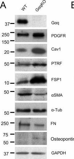 Fig.1.A showing Western Blotting in a Mus musculus (House mouse) sample from the publication: Loss of Gαq reshapes fibroblast traits and drives tumor-stroma remodeling in oral cancer progression.