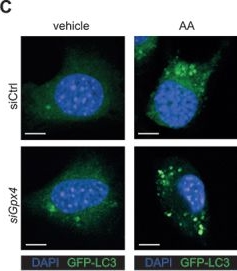Fig.2.C showing Immunocytochemistry-immunofluorescence from the publication: Chronic enteritis triggered by diet westernization is driven by epithelial ATG16L1-mediated autophagy.