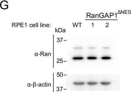 Fig.6.G showing Western Blotting from the publication: Structural basis for a nucleoporin exportin complex between RanBP2, SUMO1-RanGAP1, the E2 Ubc9, Crm1 and the Ran GTPase.