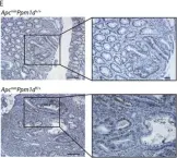 Fig.4.E showing Immunohistochemistry in a Mus musculus (House mouse) sample from the publication: Truncated PPM1D impairs stem cell response to genotoxic stress and promotes growth of APC-deficient tumors in the mouse colon.