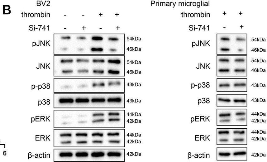 Fig.4.B showing Western Blotting in a Mus musculus (House mouse) sample from the publication: LncRNA TCONS_00145741 Knockdown Prevents Thrombin-Induced M1 Differentiation of Microglia in Intracerebral Hemorrhage by Enhancing the Interaction Between DUSP6 and JNK.