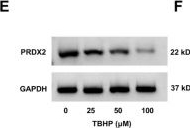 Fig.1.E showing Western Blotting in a Homo sapiens (Human) sample from the publication: Ubiquitination-mediated PRDX2 alleviates intervertebral disc degeneration via restraining TBHP-induced nucleus pulposus cell apoptosis, ferroptosis and ECM degradation.