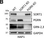 Fig.6.B showing Western Blotting in a Homo sapiens (Human) sample from the publication: Intracellular Proteolysis of Progranulin Generates Stable, Lysosomal Granulins that Are Haploinsufficient in Patients with Frontotemporal Dementia Caused by GRN Mutations.