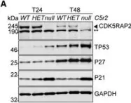 Fig.7.A showing Western Blotting from the publication: Centrosome function is critical during terminal erythroid differentiation.