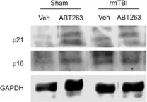 Fig.7.B showing Western Blotting in a Mus musculus (House mouse) sample from the publication: Neurons and glial cells acquire a senescent signature after repeated mild traumatic brain injury in a sex-dependent manner.