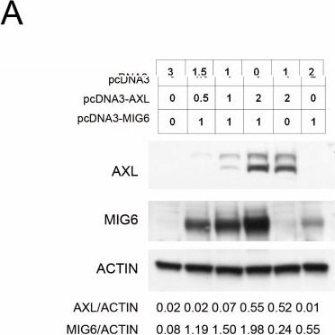 Fig.3.A showing Western Blotting in a Homo sapiens (Human) sample from the publication: Intervention of AXL in EGFR Signaling via Phosphorylation and Stabilization of MIG6 in Non-Small Cell Lung Cancer.