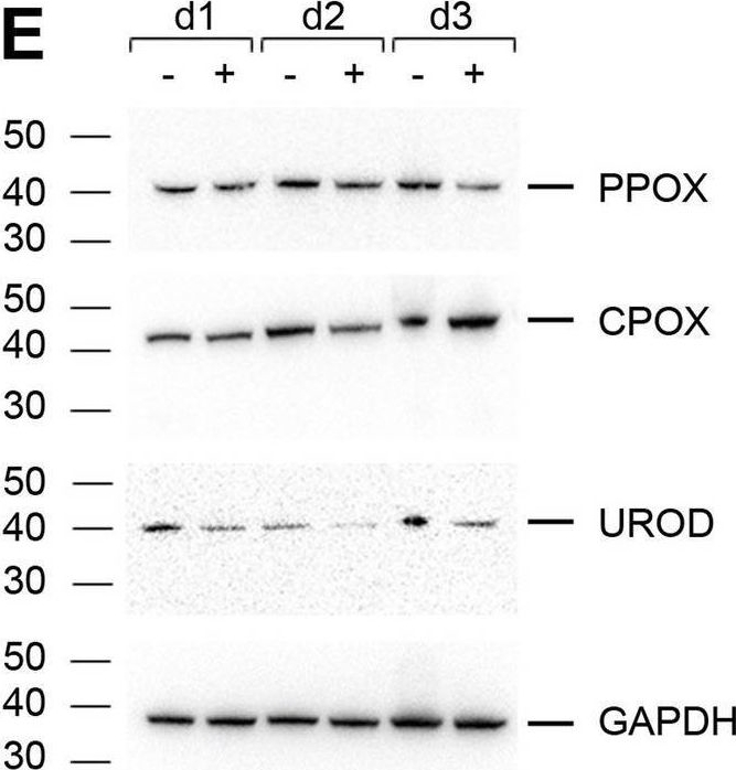 Fig.1.E showing Western Blotting from the publication: SARS-CoV-2 Infects Red Blood Cell Progenitors and Dysregulates Hemoglobin and Iron Metabolism.
