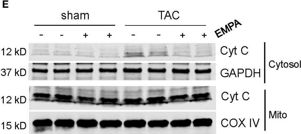 Fig.4.E showing Western Blotting in a Mus musculus (House mouse) sample from the publication: Direct Cardiac Actions of Sodium-Glucose Cotransporter 2 Inhibition Improve Mitochondrial Function and Attenuate Oxidative Stress in Pressure Overload-Induced Heart Failure.