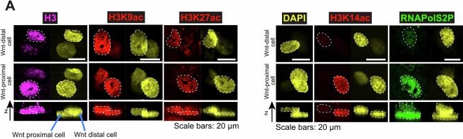 Fig.2.A showing Immunocytochemistry-immunofluorescence from the publication: Wnt-presenting materials sustain H3K14-acetylation in human skeletal stem cells for tissue engineering and bone repair.